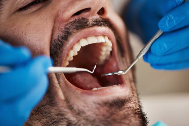 Professional Holistic Dental Care Services in Scotts Valley, CA